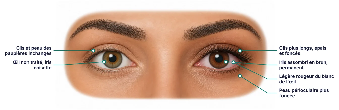 Deux yeux côte à côte : l'œil traité a un iris plus foncé et des cils plus longs